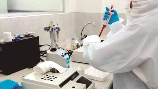 Inlasa aclara que en Bolivia se utilizan pruebas PCR específicas para Covid-19