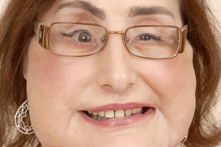 Murió Connie Culp, la mujer que recibió el primer trasplante facial en Estados Unidos
