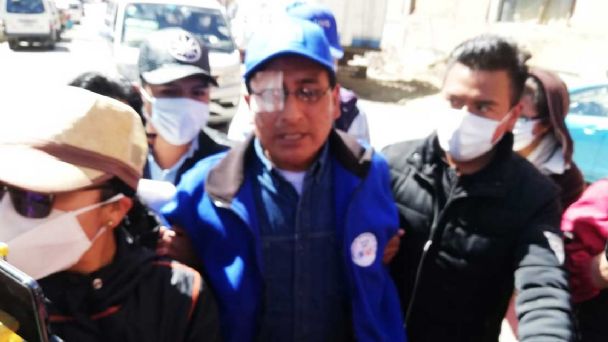 Jefe del MAS El Alto puede perder la visión de un ojo tras agresión