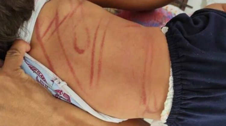 Dictan detención preventiva para agresoras de flagelar a dos menores en Warnes