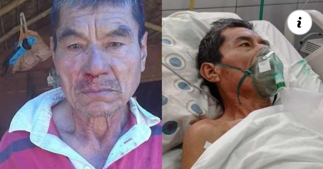 El conflicto por la tierra en San Ignacio cobra su primera víctima; muere el chiquitano que fue agredido cuando defendía su predio de un asentamiento
