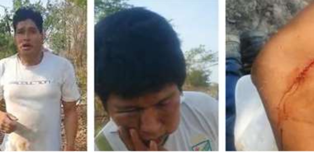 Dueño de predio es atacado a tiros y con machete por avasalladores en una comunidad de San Julián
