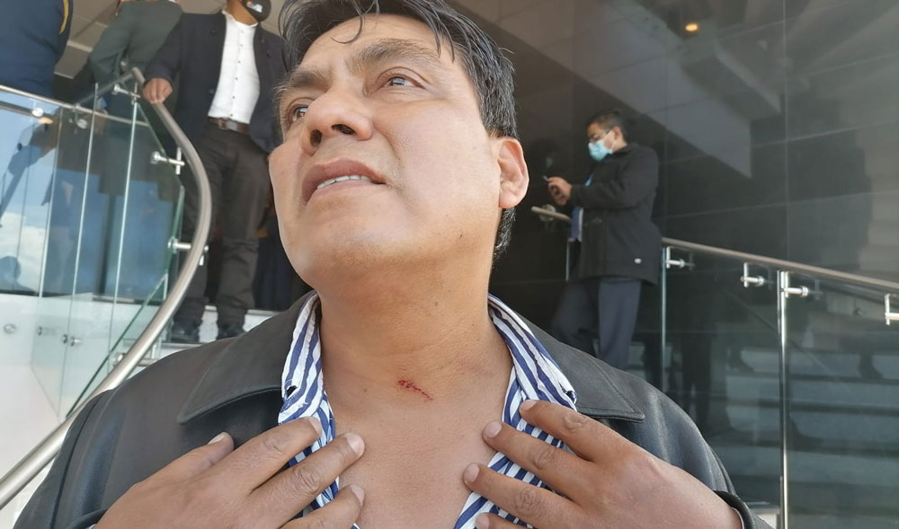 Dan cinco días de impedimento al diputado Héctor Arce por los ‘arañazos’