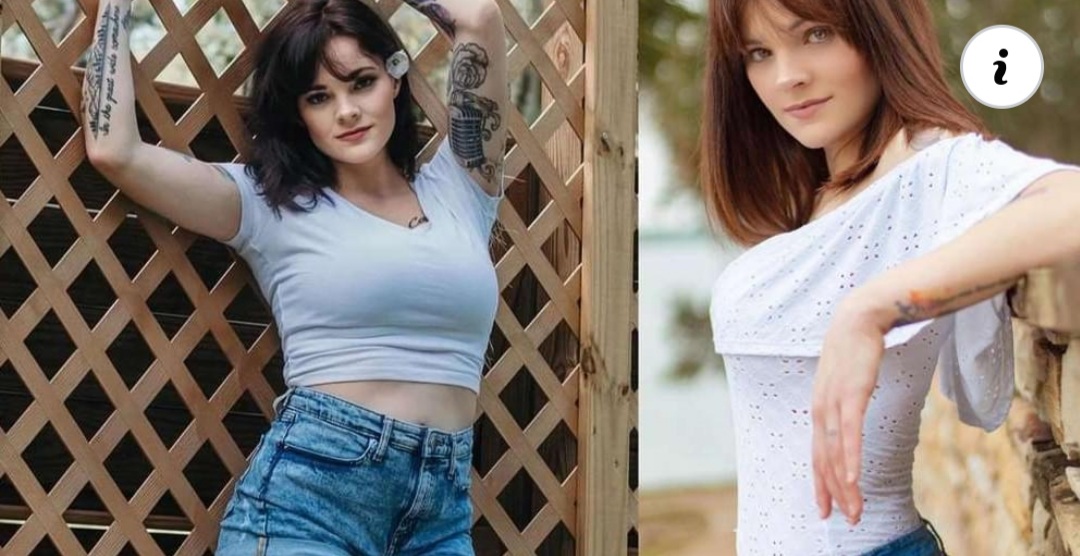 Fue por una reducción de senos y despertó con implantes y una abdominoplastia