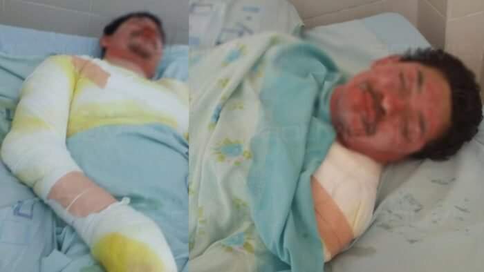 Una pareja casi muere calcinada en Santa Cruz