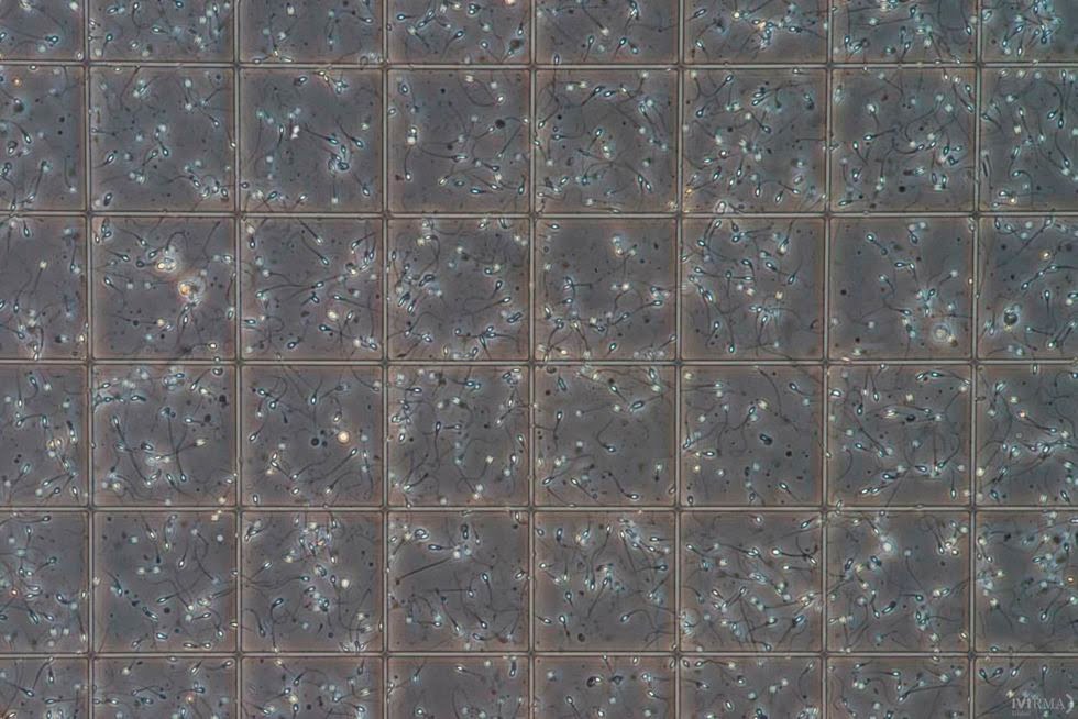 La calidad del esperma de los humanos ha bajado a la mitad en el último medio siglo