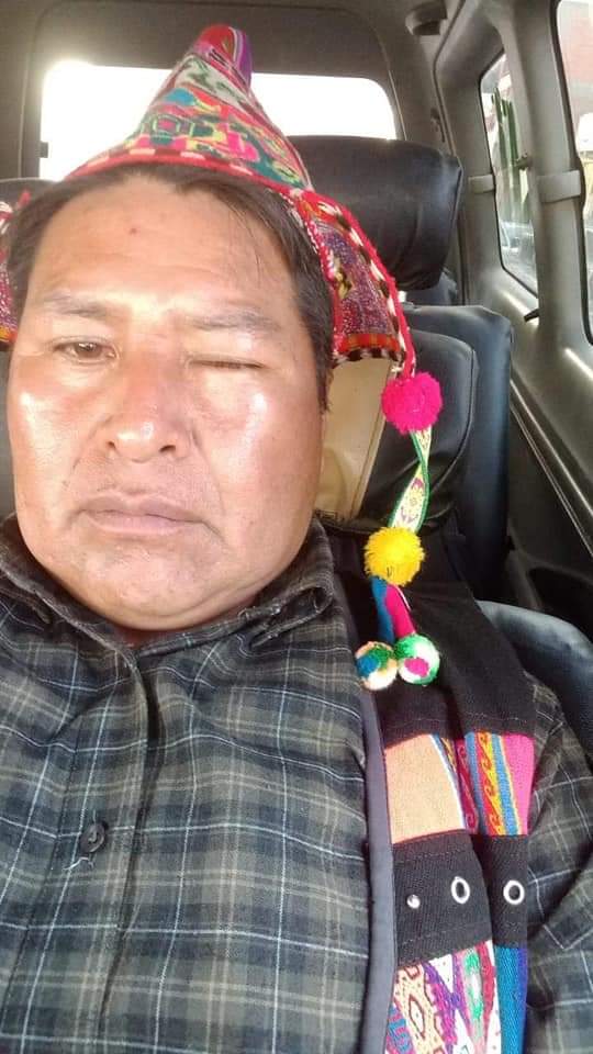 Funcionario que empujó la silla a Evo denuncia que fue «chicoteado» por seguidores del jefe del MAS en represalia