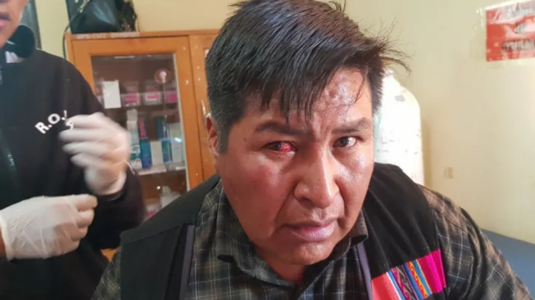 Diputado llama «matoncito» a Evo tras agresiones a dirigente que le quitó la silla