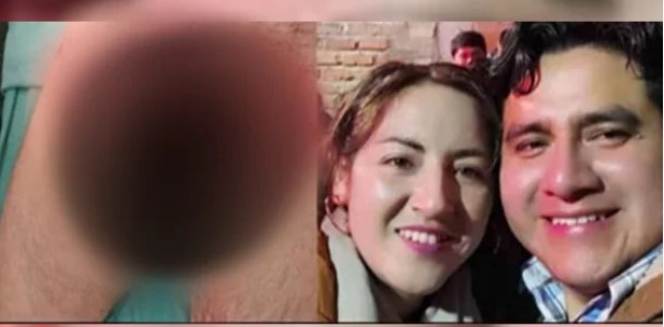 Cegada por los celos le cortó el miembro a su esposo mientras dormía por una supuesta infidelidad