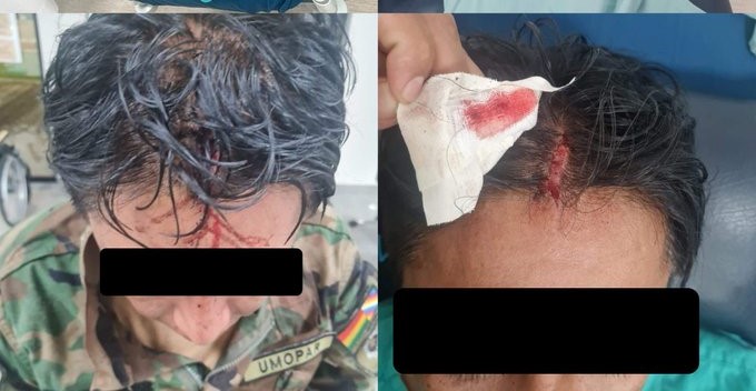 Uniformados de la Felcn fueron atacados cuando destruían una fábrica de cocaína
