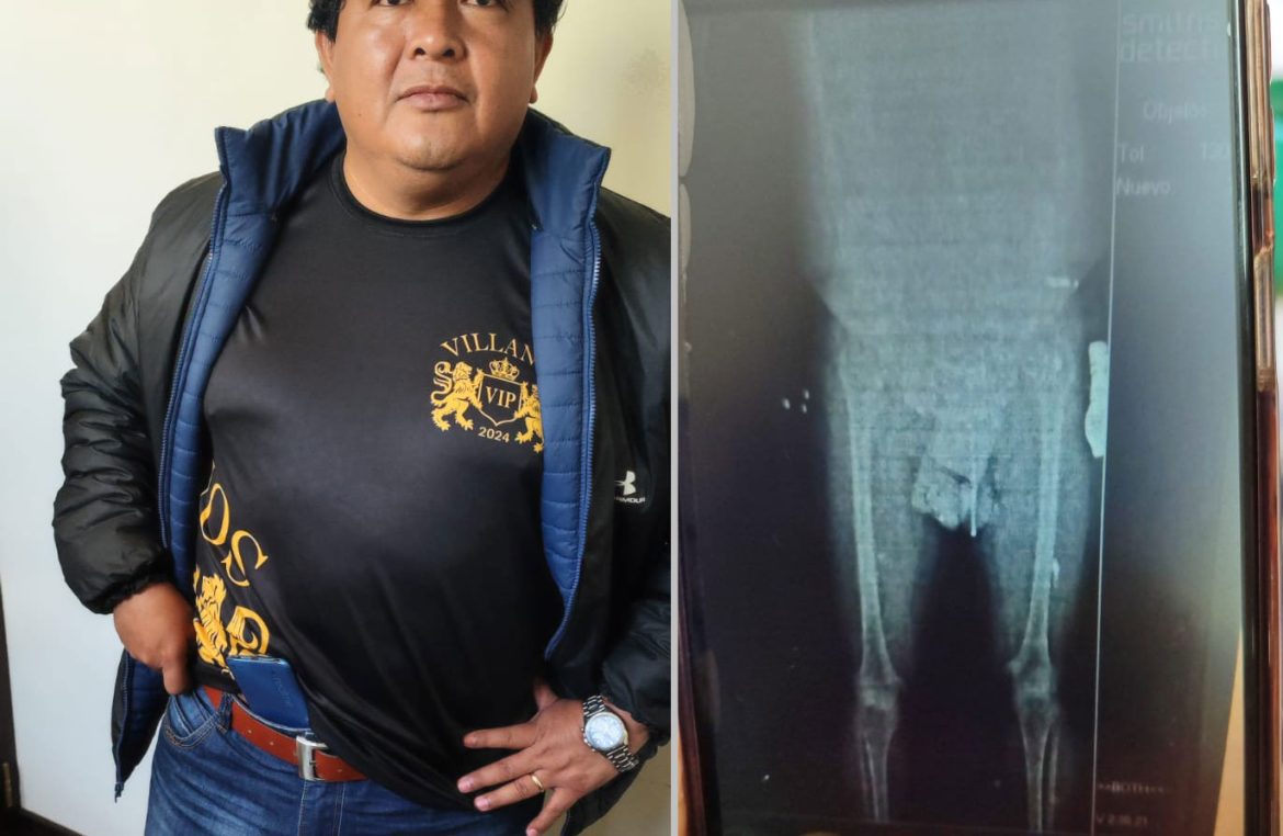 Un diputado intentó ingresar a Chonchocoro con un celular oculto en sus partes íntimas